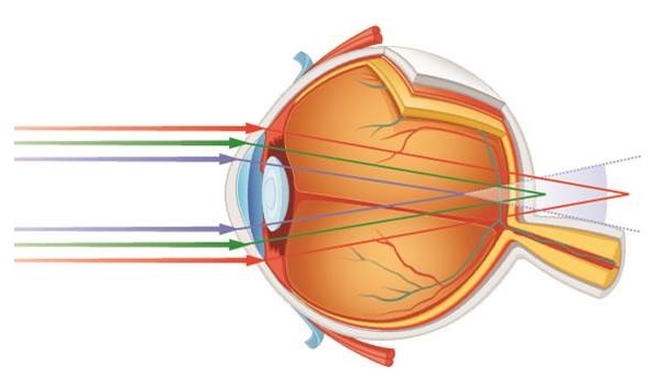Преломление синего света в глазу человека